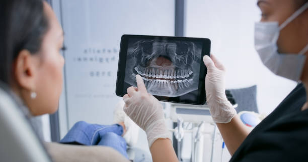 Licensed Tooth Extraction service in Newberry, SC - Smile Center Dentistry